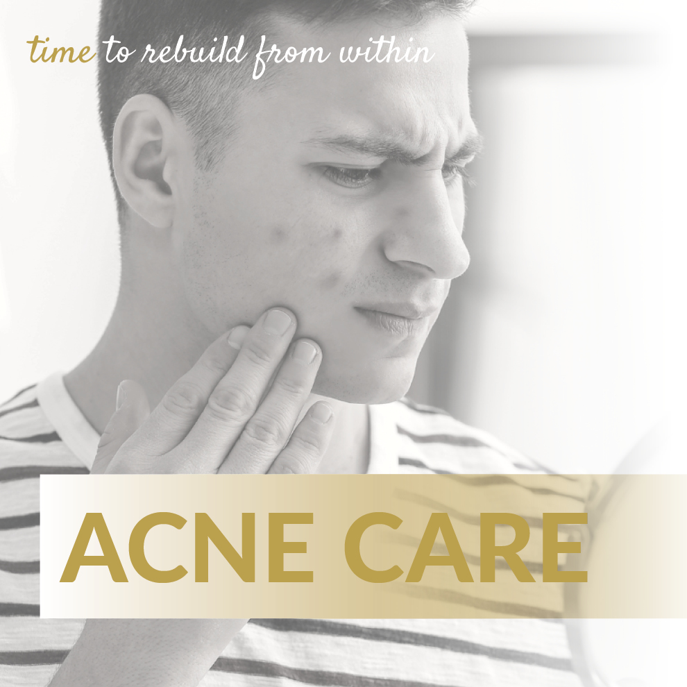 CARE B2C product image webshop26 Acne Care - Image 1