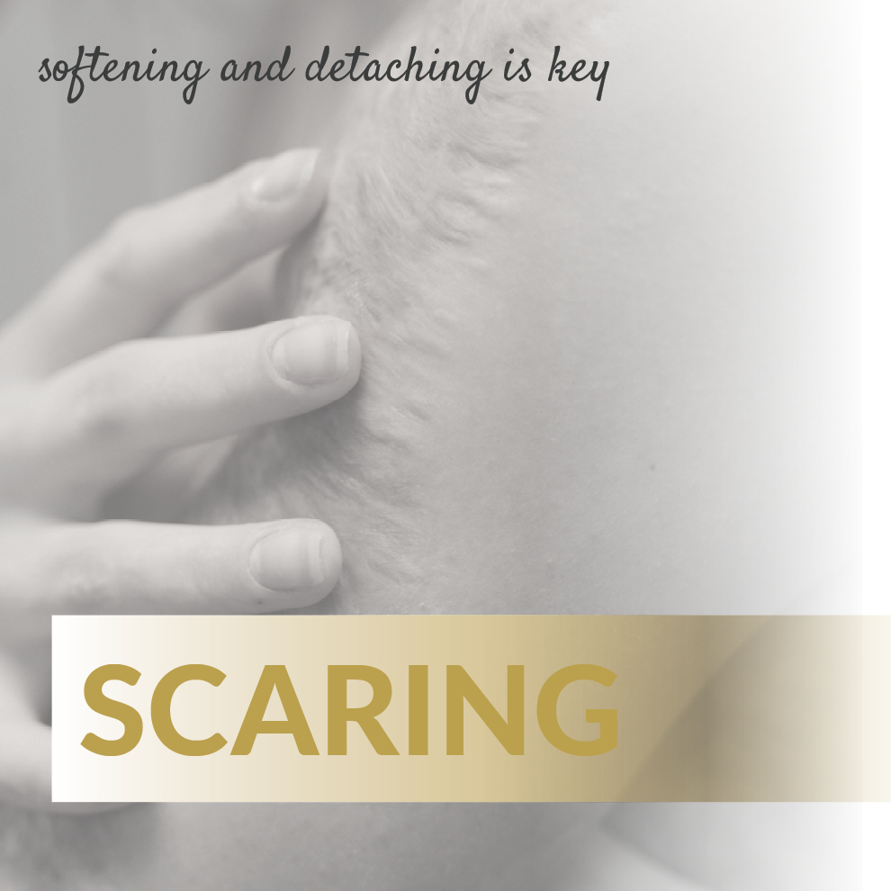 CARE B2C product image webshop27 Scar - Image 1